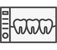 Implant Dentures